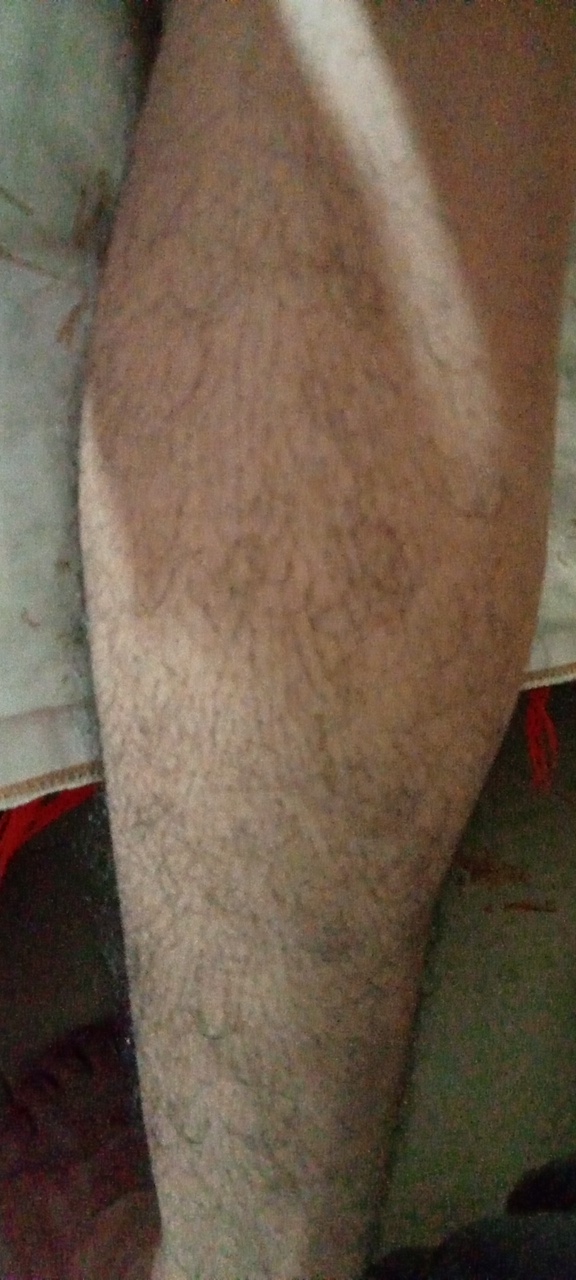 Pelitos del pie